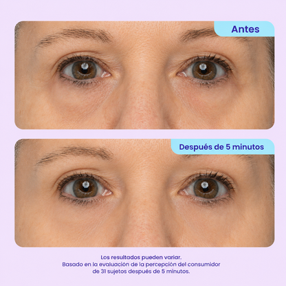 Gel de Ojos con Efecto Rejuvenecedor Instantáneo - #1 más viral en TikTok